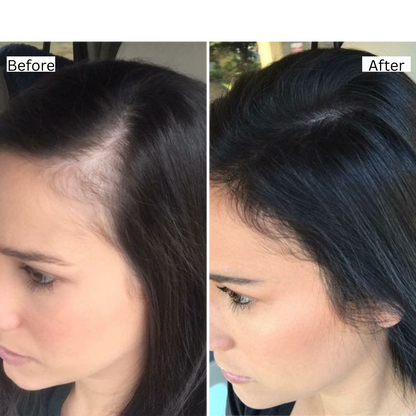 Rosemary Natural Hair Growth Oil