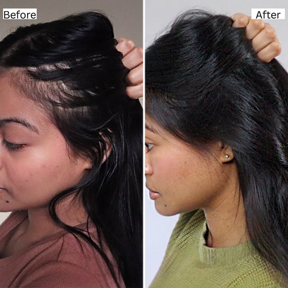 Rosemary Natural Hair Growth Oil