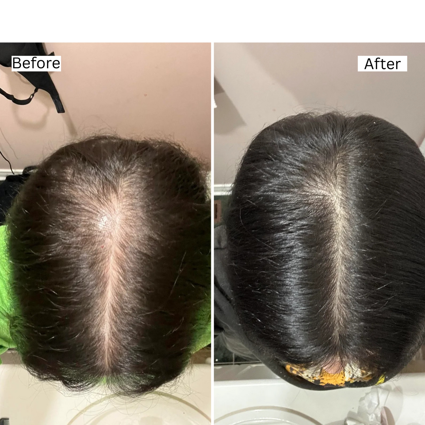 Rosemary Natural Hair Growth Oil