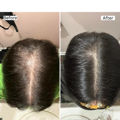 Rosemary Natural Hair Growth Oil